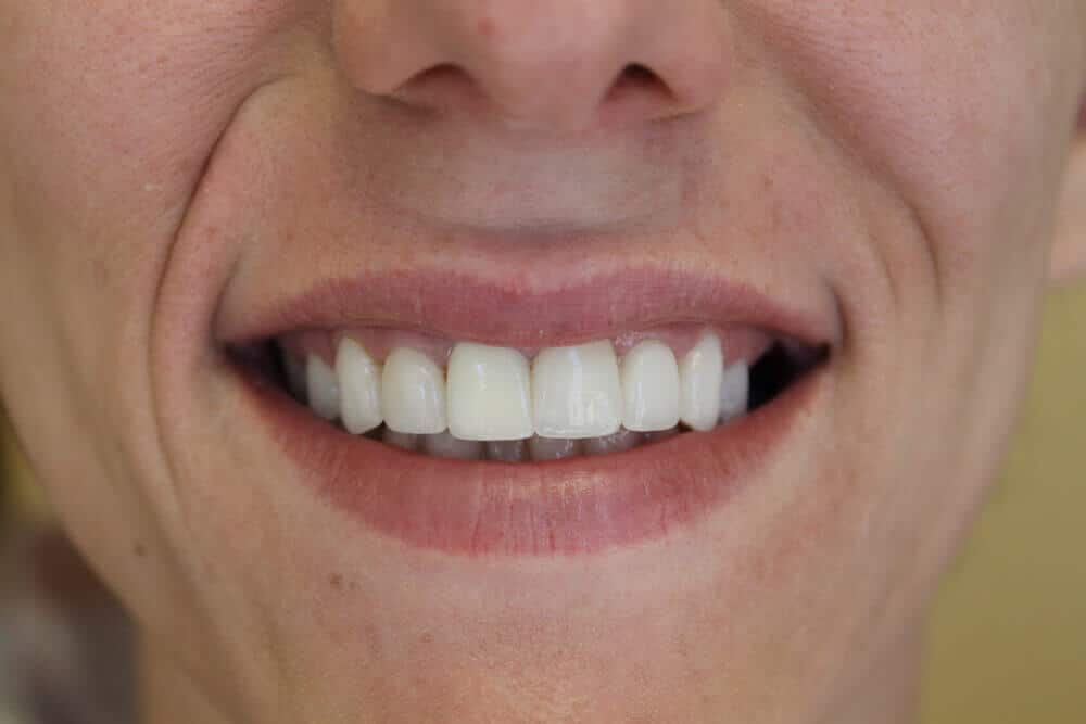 dental care