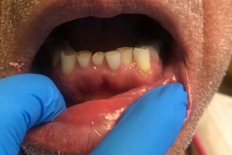 dental care