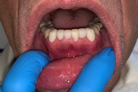 dental care