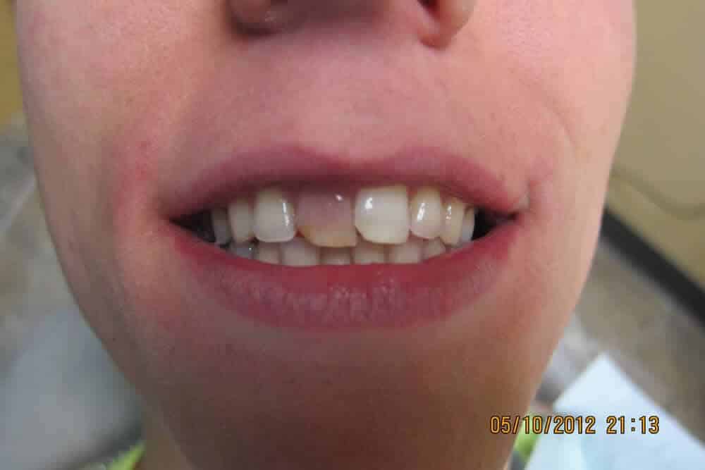 dental care