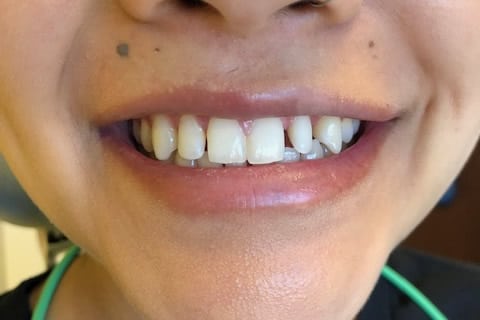 dental care