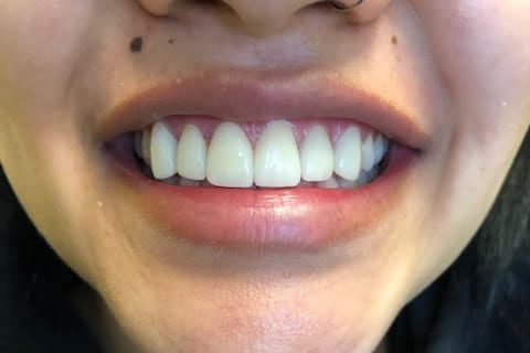dental care