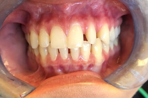 dental care