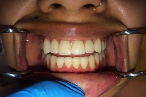 dental care