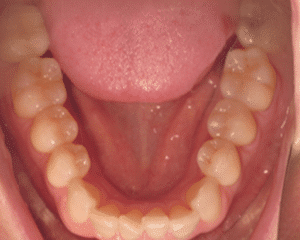 dental care