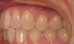 Dental Care