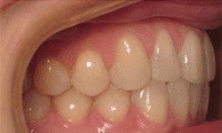 dental care
