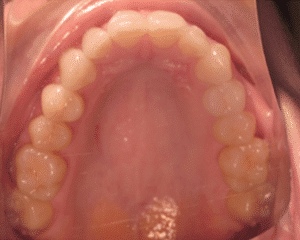 dental care