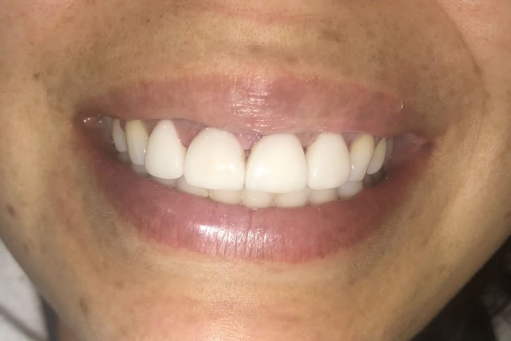 dental care