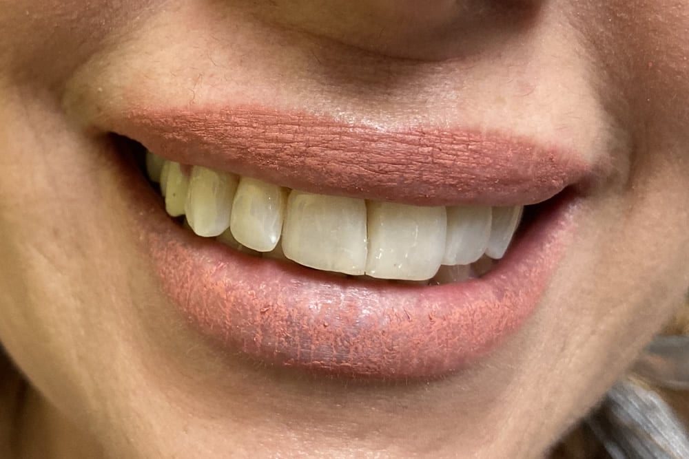 dental care