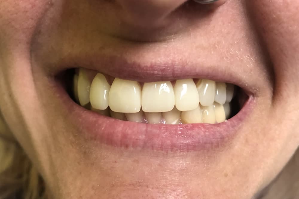 dental care