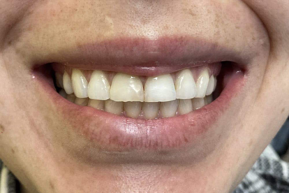 dental care