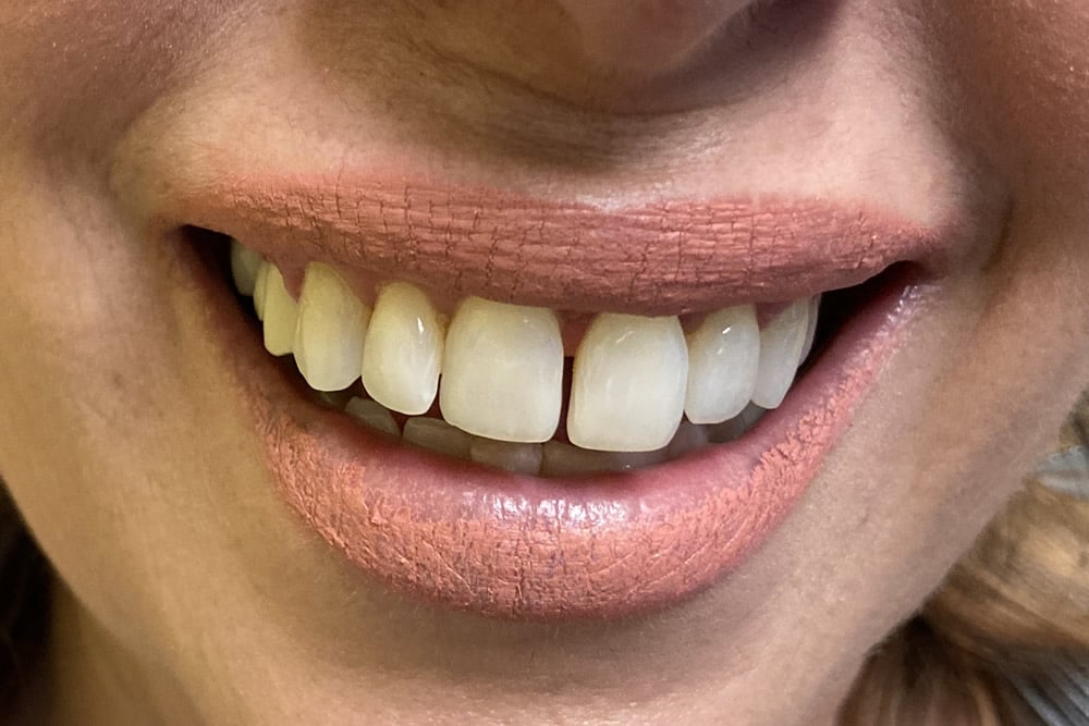dental care