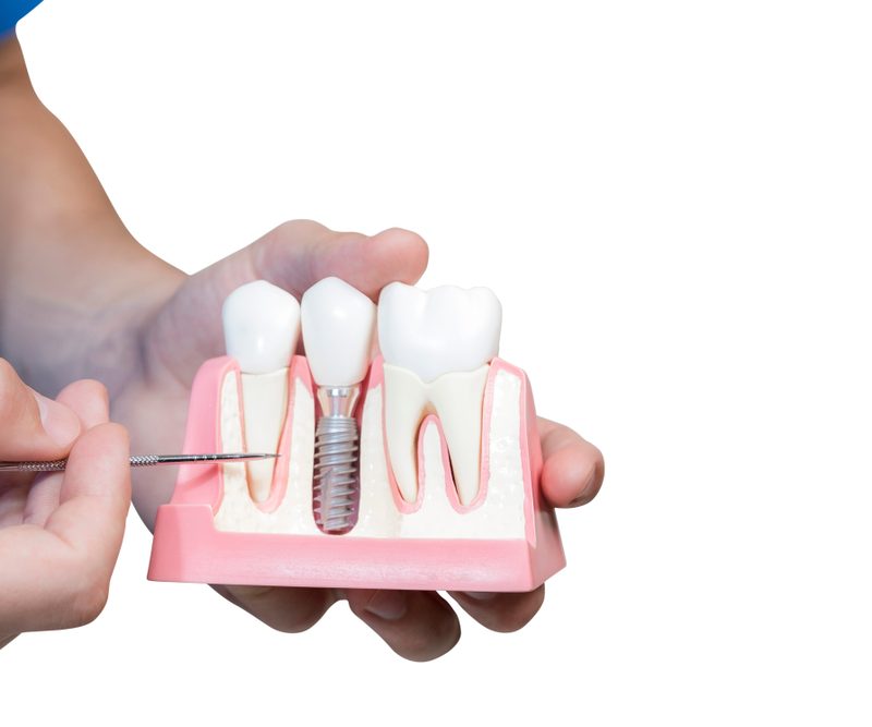 handsofthedentistholdabreadboardmodelofthe