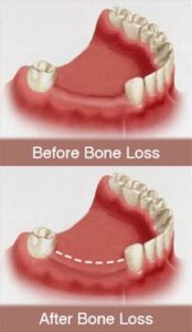 dental care